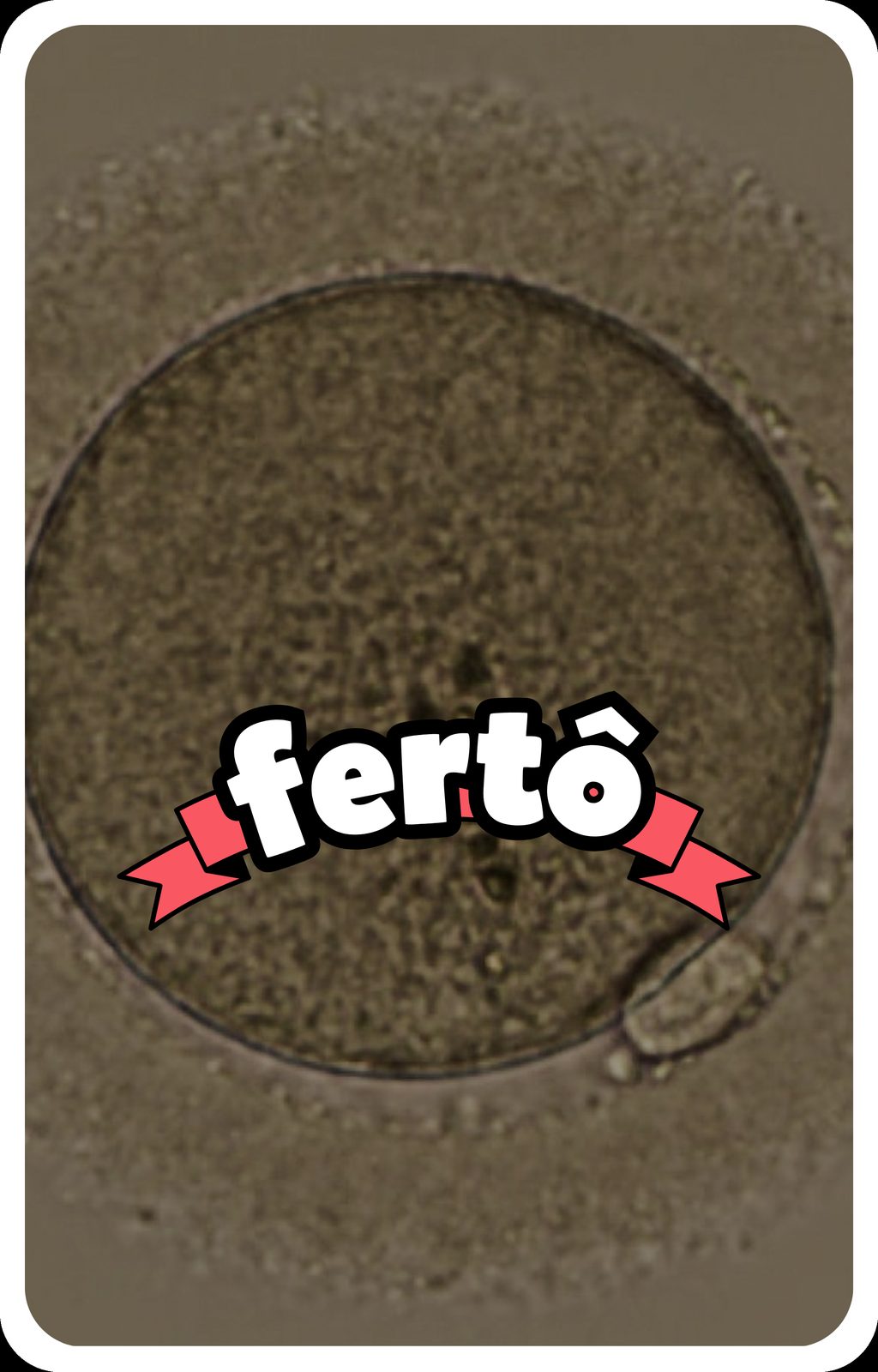fertô fodão 41